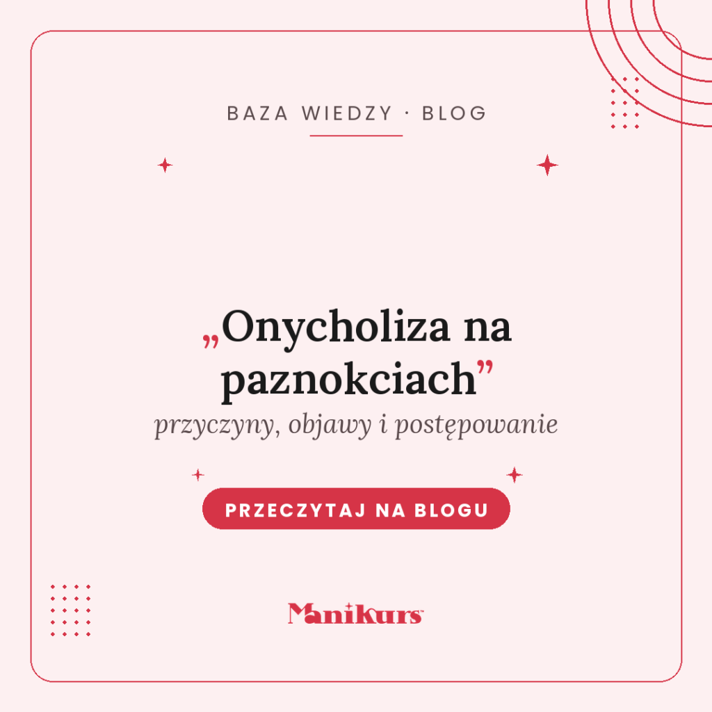 onycholiza na paznokciach